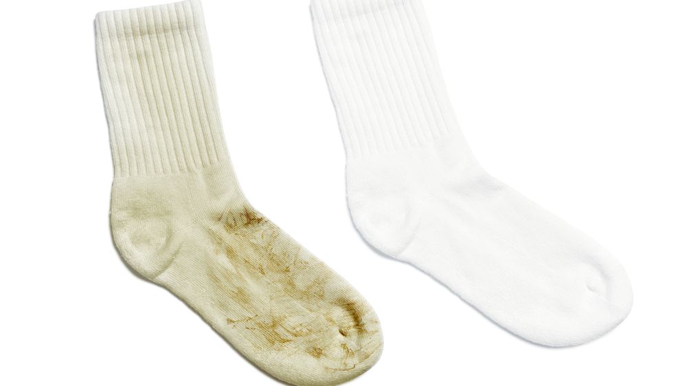 Jak odstranit tmavé skvrny z bílých ponožek